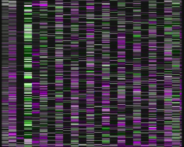 Weather Camera Image Road 7 Porvoo, Ilola, Porvoo, Uusimaa