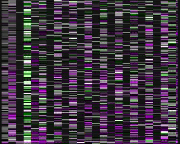 Weather Camera Image Road 7 Porvoo, Ilola, Porvoo, Uusimaa