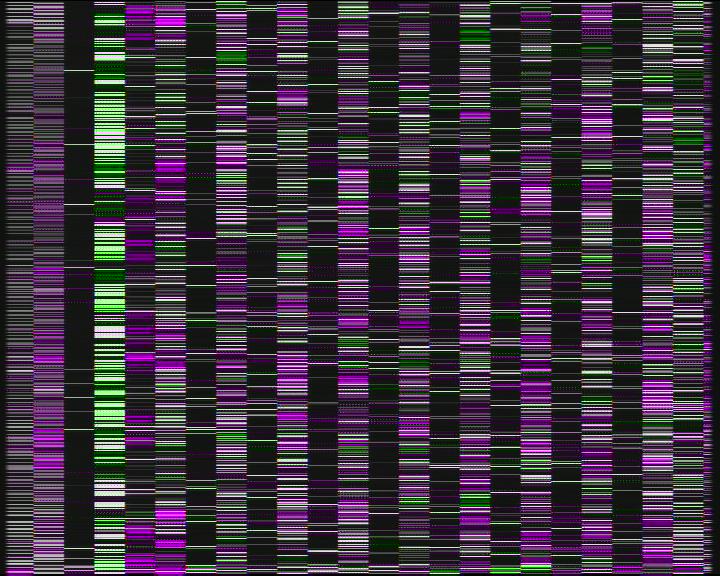 Weather Camera Image Road 7 Porvoo, Ilola, Porvoo, Uusimaa