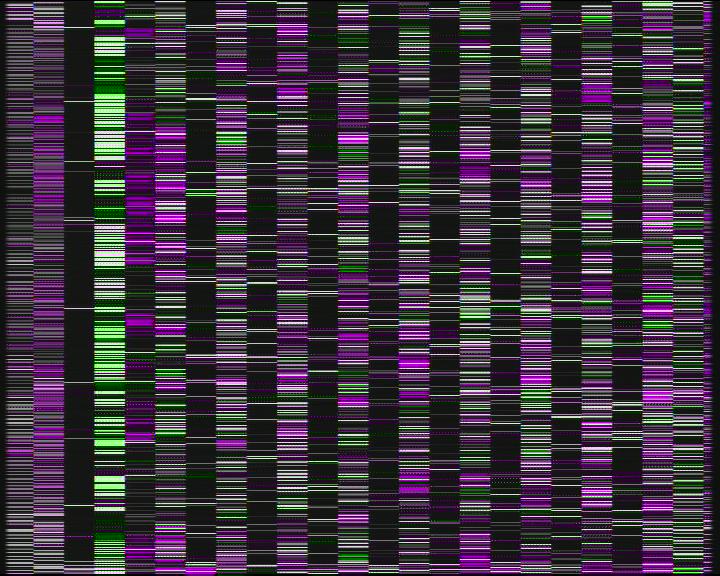 Weather Camera Image Road 7 Porvoo, Ilola, Porvoo, Uusimaa