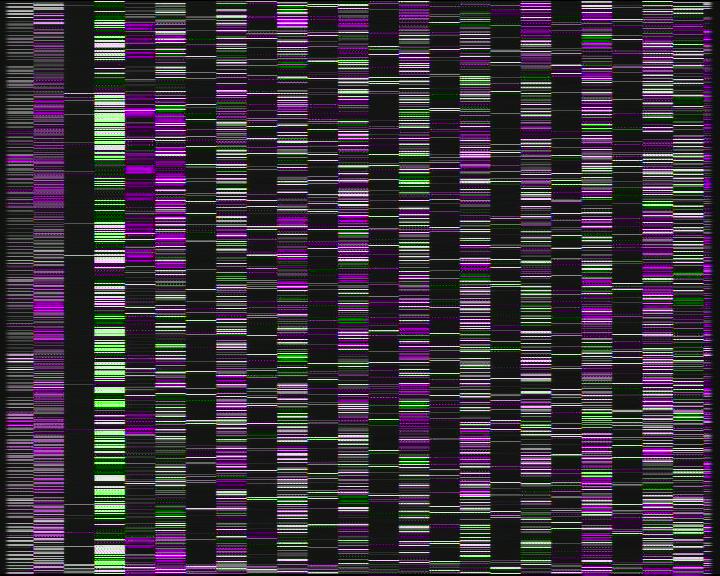Weather Camera Image Road 7 Porvoo, Ilola, Porvoo, Uusimaa