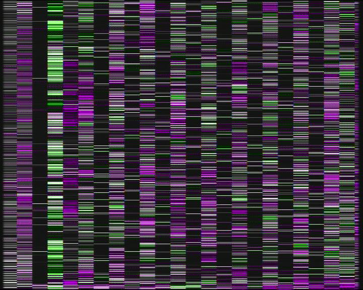 Weather Camera Image Road 7 Porvoo, Ilola, Porvoo, Uusimaa