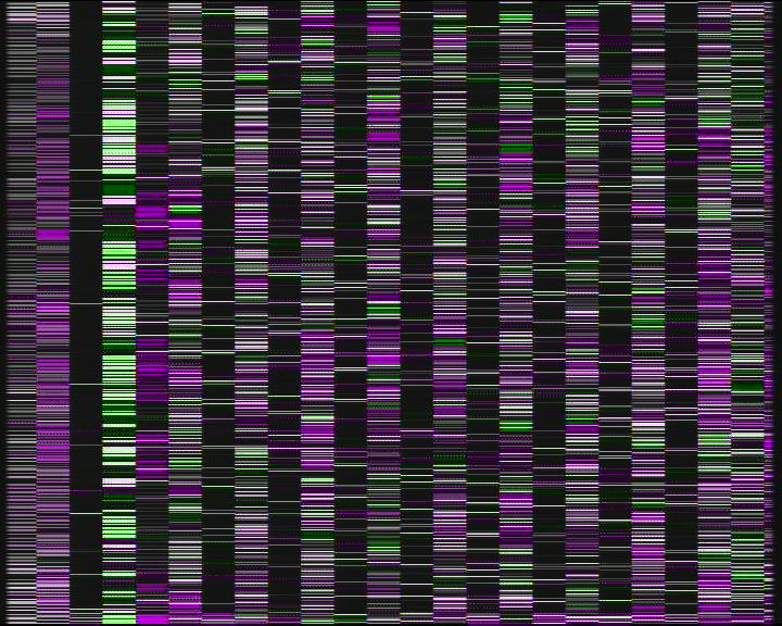 Weather Camera Image Road 7 Porvoo, Ilola, Porvoo, Uusimaa