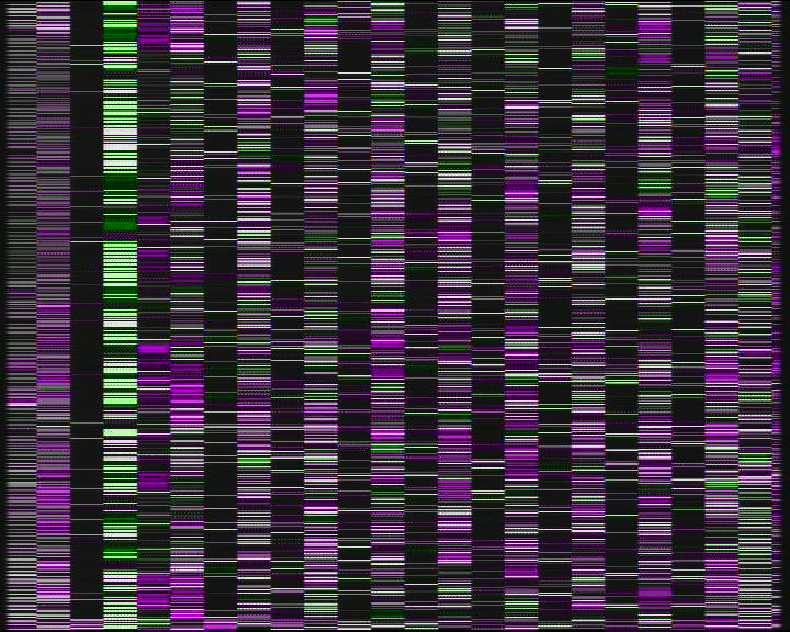 Weather Camera Image Road 7 Porvoo, Ilola, Porvoo, Uusimaa