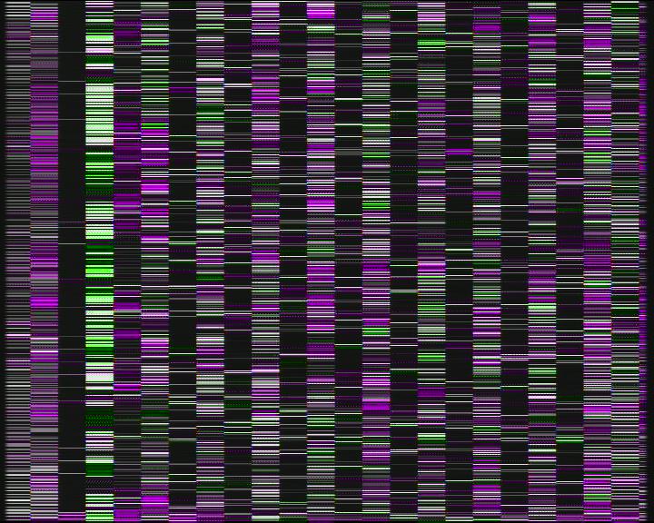 Weather Camera Image Road 7 Porvoo, Ilola, Porvoo, Uusimaa