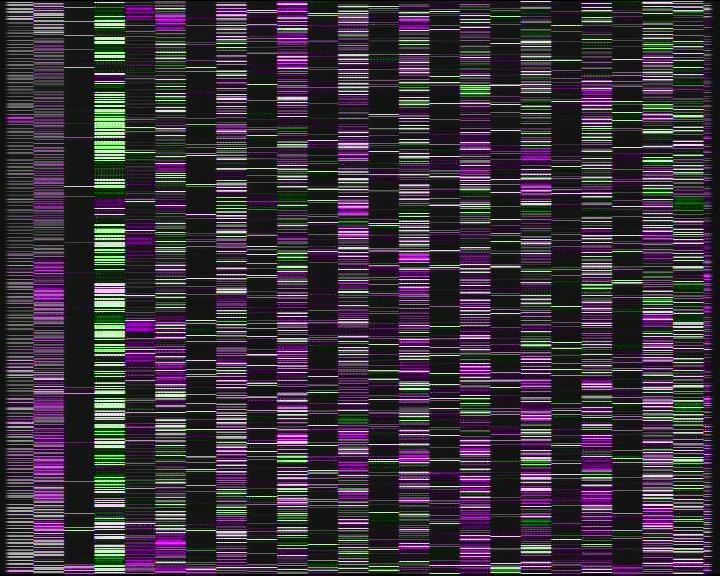 Weather Camera Image Road 7 Porvoo, Ilola, Porvoo, Uusimaa