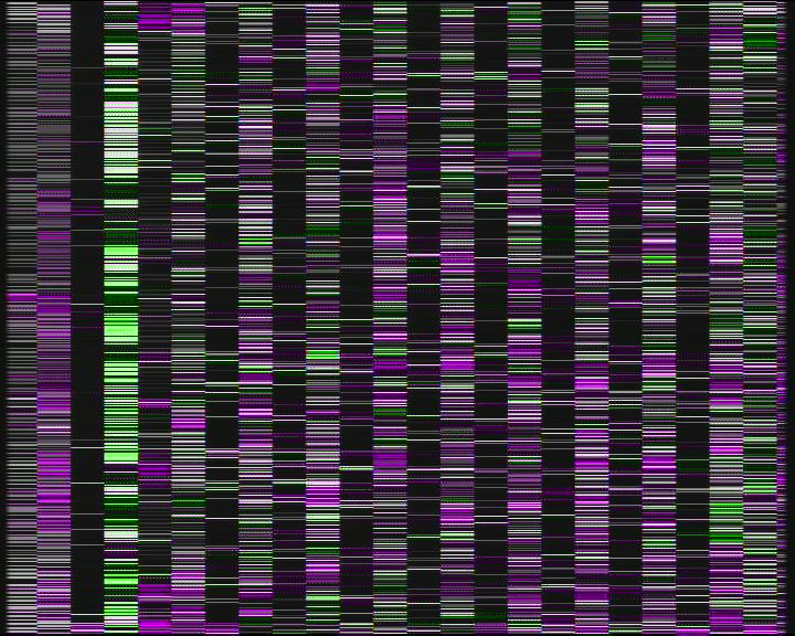 Weather Camera Image Road 7 Porvoo, Ilola, Porvoo, Uusimaa