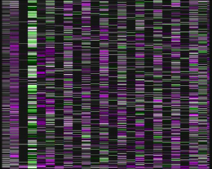 Weather Camera Image Road 7 Porvoo, Ilola, Porvoo, Uusimaa