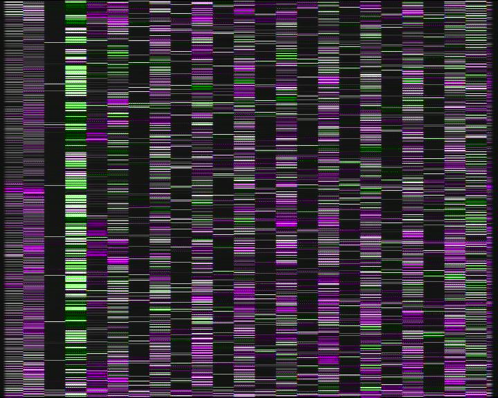 Weather Camera Image Road 7 Porvoo, Ilola, Porvoo, Uusimaa