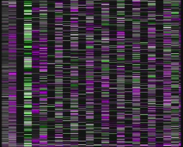 Weather Camera Image Road 7 Porvoo, Ilola, Porvoo, Uusimaa