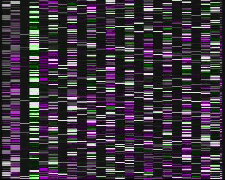 Weather Camera Image Road 7 Porvoo, Ilola, Porvoo, Uusimaa