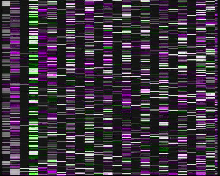 Weather Camera Image Road 7 Porvoo, Ilola, Porvoo, Uusimaa