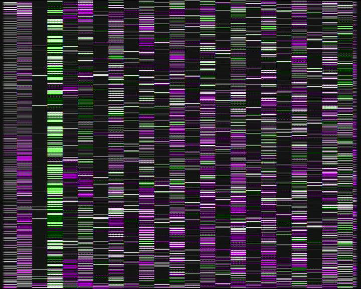 Weather Camera Image Road 7 Porvoo, Ilola, Porvoo, Uusimaa