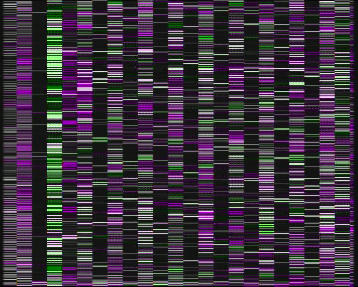 Weather Camera Image Road 7 Porvoo, Ilola, Porvoo, Uusimaa