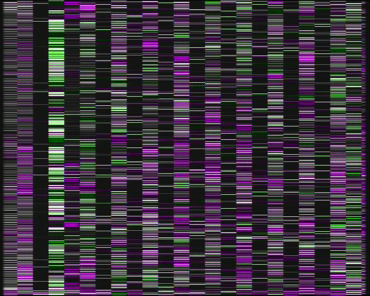 Weather Camera Image Road 7 Porvoo, Ilola, Porvoo, Uusimaa