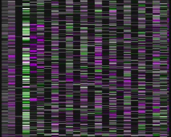 Weather Camera Image Väg 7 Kotka Otsola, Kotka, Kymenlaakso